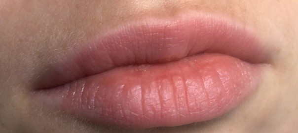 Wat je moet weten over lipverzorging